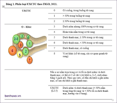 Phân Loại U Xơ Tử Cung Theo FIGO